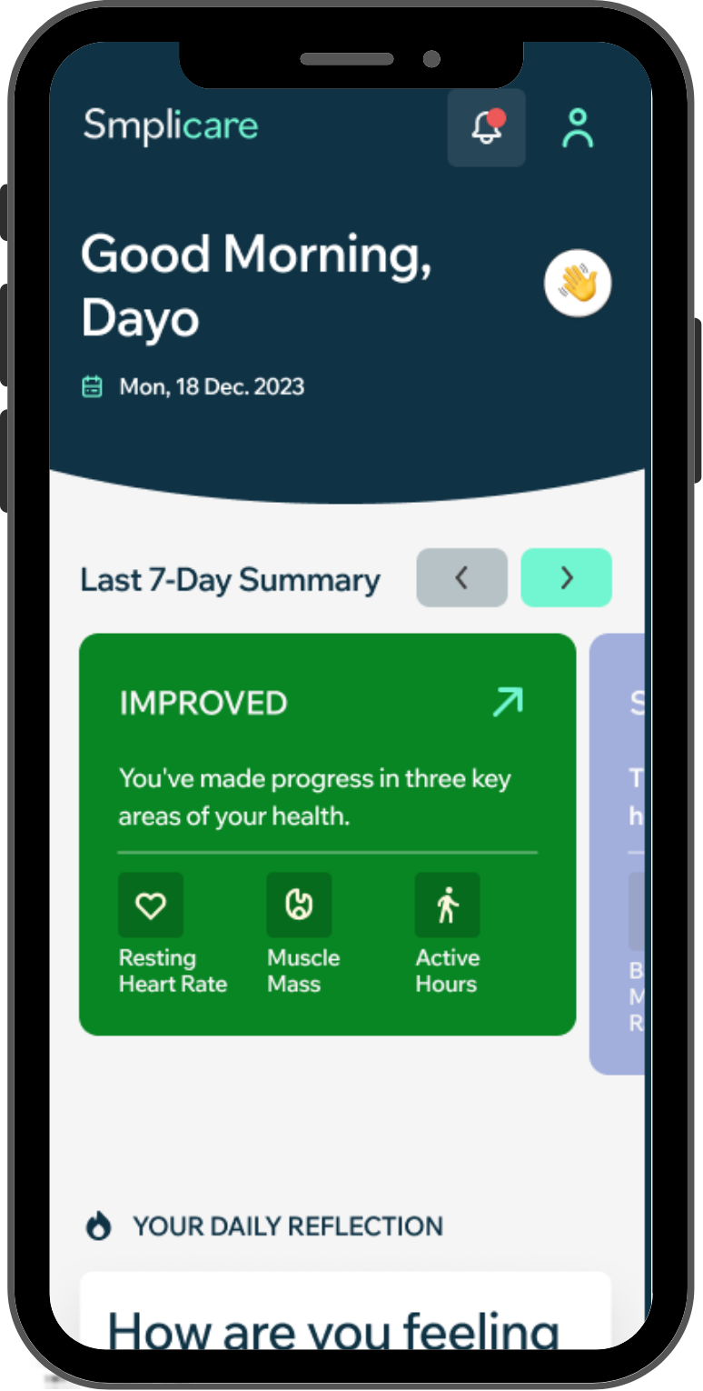 Smplicare React Native rebuild, 2024